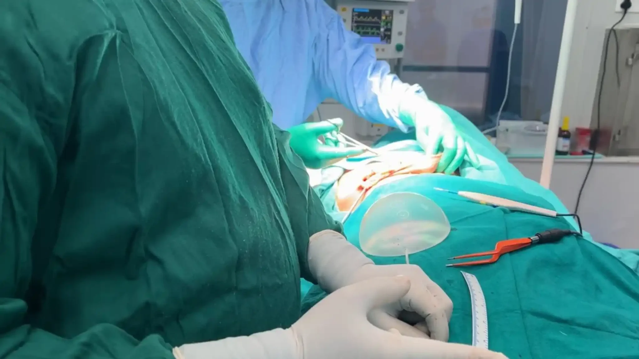 Understanding Breast Cancer Stages and Their Treatment Options