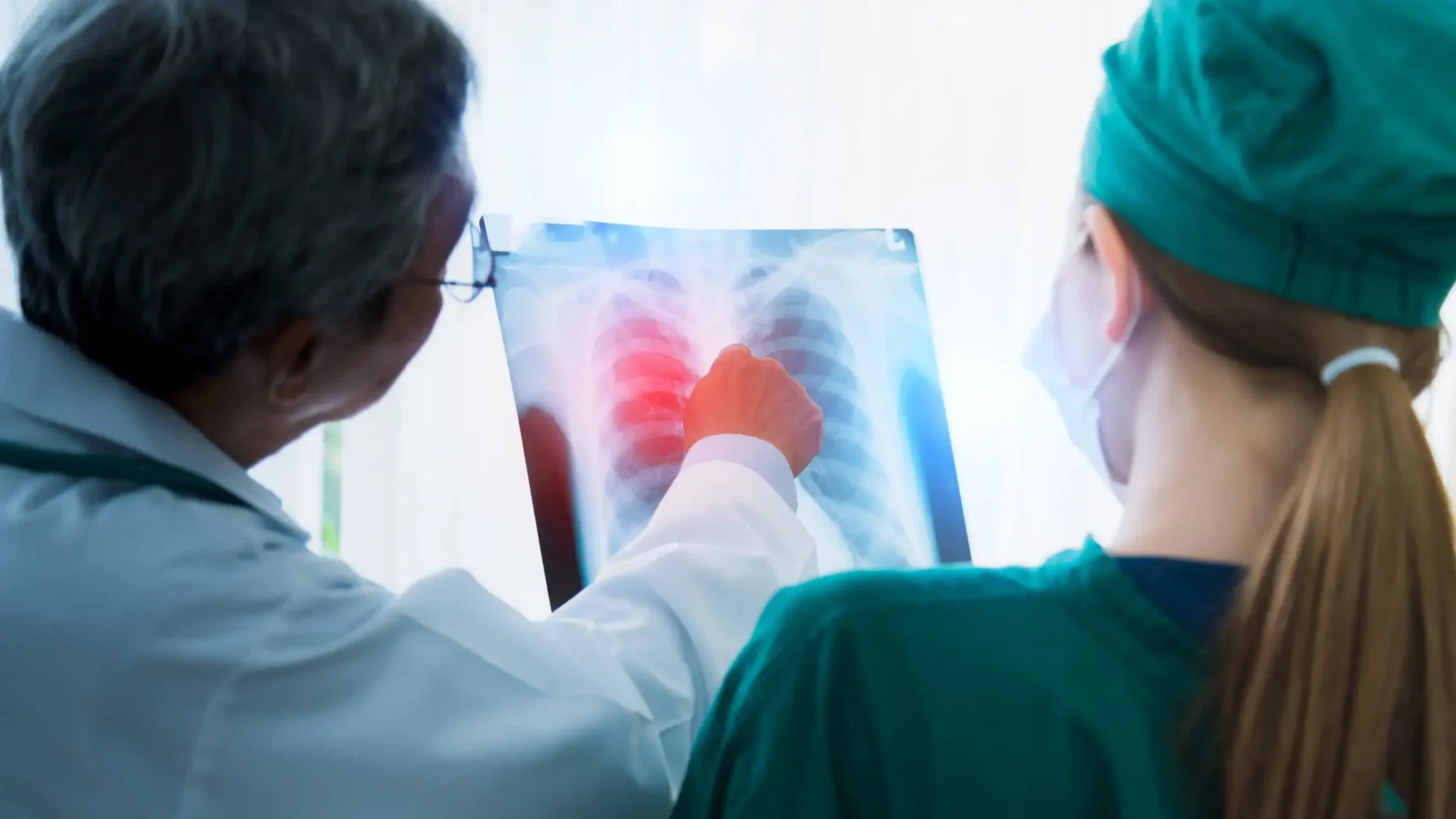 Breath to Diagnosis: Can Your Breath Detect Early Lung Cancer Signs?