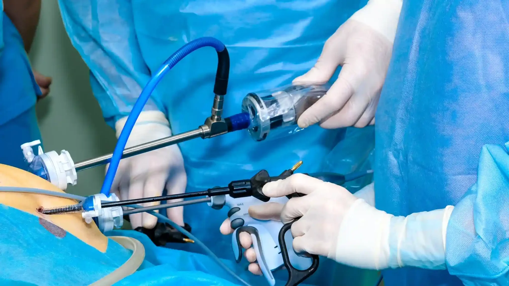 Palliative Care vs. Hospice Care: Understanding the Key Differences