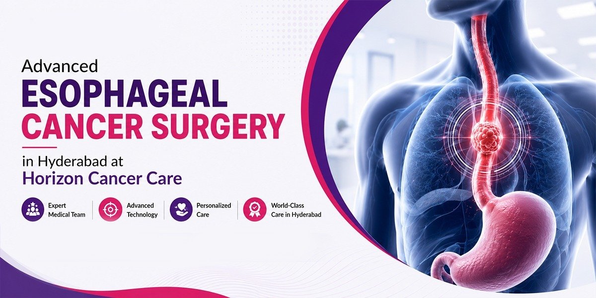 Advanced Esophageal Cancer Surgery in Hyderabad at Horizon Cancer Care